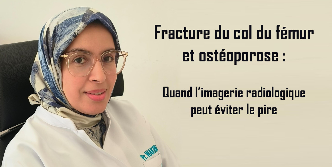 Fracture du col du fémur et ostéoporose: quand l’imagerie radiologique peut éviter le pire